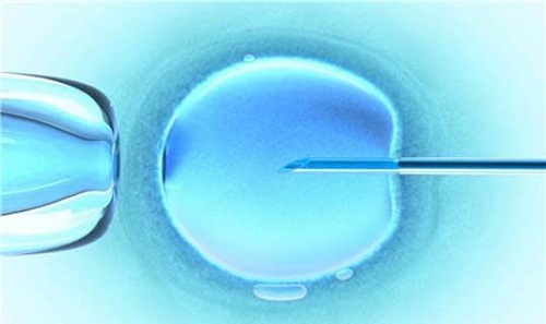 泰国试管解析子宫输卵管造影的优缺点